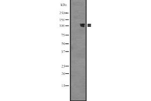 Western blot analysis of PKN3 expression in Hela cell lysate,The lane on the left is treated with the antigen-specific peptide.