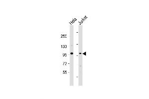 Western Blot at 1:1000 dilution Lane 1: Hela whole cell lysate Lane 2: Jurkat whole cell lysate Lysates/proteins at 20 ug per lane. (NSUN2 antibody  (AA 423-451))