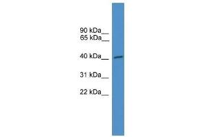 Western Blot showing NXF5 antibody used at a concentration of 1-2 ug/ml to detect its target protein.