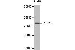 Western blot analysis of extracts of A549 cell line, using PEG10 antibody.