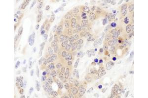 Immunohistochemistry (IHC) image for anti-Chaperonin Containing TCP1, Subunit 3 (Gamma) (CCT3) (AA 495-545) antibody (ABIN7453615) (CCT3 antibody  (AA 495-545))