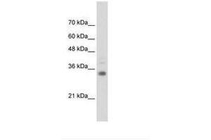 Image no. 1 for anti-Homeobox B4 (HOXB4) (C-Term) antibody (ABIN6736307) (HOXB4 antibody  (C-Term))