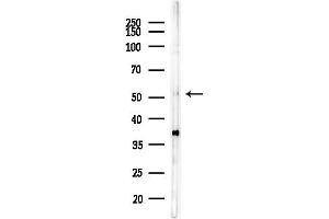 anti-6-phosphofructo-2-Kinase/fructose-2,6-Biphosphatase 3 (PFKFB3) (C-Term) antibody