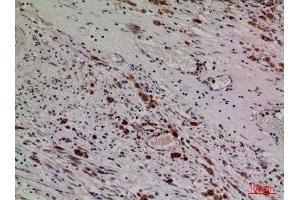 Immunohistochemistry (IHC) analysis of paraffin-embedded Human Brain, antibody was diluted at 1:100. (HDC antibody  (Internal Region))