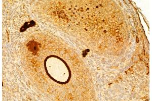 ABIN6261746 and ABIN6268882 at 1/100 staining Mouse ovary tissue by IHC-P. (Fibronectin antibody  (C-Term))