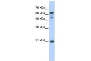 Image no. 1 for anti-Germinal Center Expressed Transcript 2 (GCET2) (C-Term) antibody (ABIN6741348) (GCET2 antibody  (C-Term))