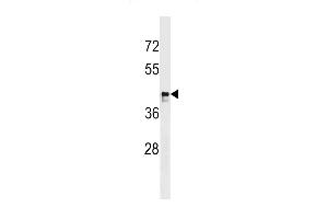 RCH9 Antibody (C-term) (ABIN1537096 and ABIN2848991) western blot analysis in SK-BR-3 cell line lysates (35 μg/lane). (MARCH9 antibody  (C-Term))