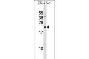 GRPEL1 Antibody (Center) (ABIN1537772 and ABIN2849483) western blot analysis in ZR-75-1 cell line lysates (35 μg/lane). (GRPEL1 antibody  (AA 116-142))