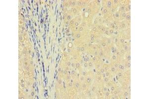 Immunohistochemistry of paraffin-embedded human liver tissue using ABIN7172006 at dilution of 1:100 (TXNDC8 antibody  (AA 1-115))