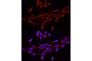 Immunofluorescence analysis of PC-12 using FA/PIEZO1 antibody (ABIN6133207, ABIN6145612, ABIN6145613 and ABIN6220594) at dilution of 1:100 (40x lens).