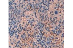 Used in DAB staining on fromalin fixed paraffin- embedded spleen tissue (TPM3 antibody  (AA 6-248))