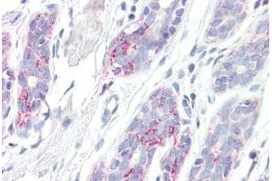 Human Breast: Formalin-Fixed, Paraffin-Embedded (FFPE) (HSD17B10 antibody  (AA 242-252))