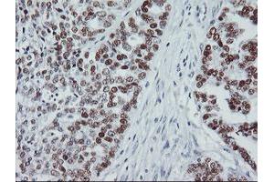 Image no. 2 for anti-Tumor Protein P53 (TP53) antibody (ABIN1499973) (p53 antibody)