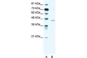 WB Suggested Anti-CNP Antibody Titration:  1. (Cnpase antibody  (N-Term))