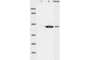 Lane 1: mouse heart lysates Lane 2: mouse kidney lysates probed with Anti CKIP-1 Polyclonal Antibody, Unconjugated (ABIN675039) at 1:200 in 4 °C.