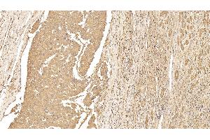 Immunohistochemistry (IHC) image for anti-Keratin 18 (KRT18) (AA 238-396) antibody (ABIN7426868)