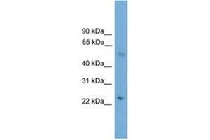 Image no. 1 for anti-Bardet-Biedl Syndrome 4 (BBS4) (AA 71-120) antibody (ABIN6745205) (BBS4 antibody  (AA 71-120))