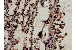 Immunocytochemistry analysis of human lung tissue using ABIN7175842 at dilution of 1:100 (WIF1 antibody  (AA 263-379))