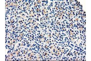 Image no. 1 for anti-Dipeptidylpeptidase 10 (DPP10) antibody (ABIN1497834) (DPP10 antibody)