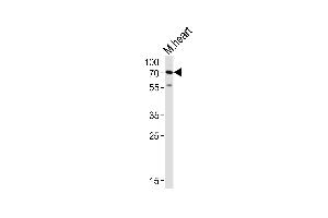 Western blot analysis of lysate from mouse heart tissue lysate, using HAS2 Antibody (Center) (ABIN651874 and ABIN2840432). (HAS2 antibody  (AA 138-166))