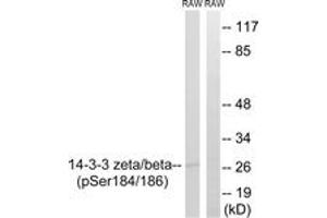Western blot analysis of extracts from RAW264. (YWHAB/YWHAZ antibody  (pSer184))