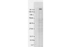 Western Blot analysis of Human Cell lysates showing detection of TrpM7 protein using Mouse Anti-TrpM7 Monoclonal Antibody, Clone S74-25 . (TRPM7 antibody  (AA 1817-1863) (PE))