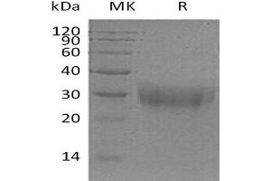 Western Blotting (WB) image for Placenta Growth Factor (PGF) (Active) protein (His tag) (ABIN7320626) (PLGF Protein (His tag))