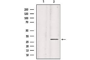 Western blot analysis of extracts from hela, using Collagen IX α2 Antibody. (Collagen Type IX alpha 2 (COL9A2) antibody)