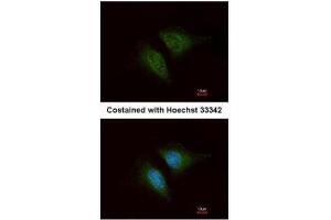 ICC/IF Image Immunofluorescence analysis of methanol-fixed HeLa, using Coronin 1C, antibody at 1:200 dilution. (CORO1C antibody  (C-Term))