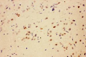 Anti-SIAH Interacting Protein antibody,IHC(P) IHC(P): Rat Brain Tissue