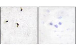Immunohistochemistry analysis of paraffin-embedded human brain tissue, using Kv2. (Kv2.1/KCNB1 antibody  (AA 533-582))