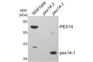 Western Blotting (WB) image for anti-Peroxisomal Biogenesis Factor 14 (PEX14) (N-Term), (pHis6) antibody (ABIN5326727) (PEX14 antibody  (N-Term, pHis6))