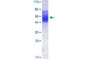 Image no. 1 for CD86 (CD86) (AA 24-246) protein (His-DYKDDDDK-Strep II Tag) (ABIN1348720) (CD86 Protein (CD86) (AA 24-246) (His-DYKDDDDK-Strep II Tag))