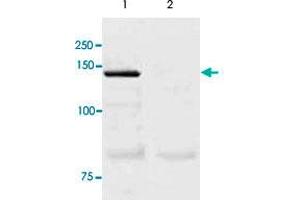 The tissue lysate derived from mouse lung was immunoprecipitated by NOS3 polyclonal antibody , then immuno-blotted by the same antibody at 1 : 500 (lane 1).