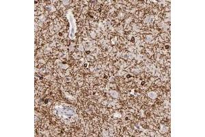 Immunohistochemical staining of human cerebral cortex with ZC3H7B polyclonal antibody  shows strong cytoplasmic positivity in glial cells at 1:50-1:200 dilution.