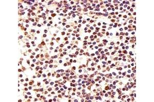 Immunohistochemical analysis of paraffin-embedded human lymph using PCNA antibody at 1:25 dilution. (PCNA antibody  (AA 236-261))