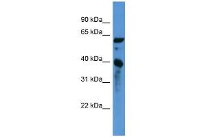 WB Suggested Anti-CNN3 Antibody Titration: 0. (CNN3 antibody  (C-Term))