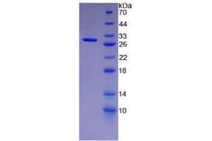 SDS-PAGE analysis of Human Keratin 18 Protein.