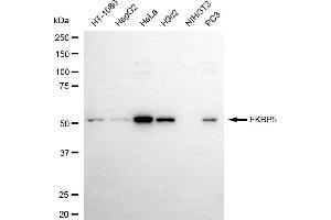 Western blotting analysis using FKBP5 antibody (ABIN7798625).