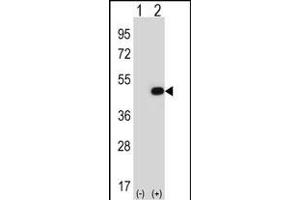 Western blot analysis of EIF2B3 (arrow) using rabbit polyclonal EIF2B3 Antibody (ABIN388637 and ABIN2838310). (EIF2B3 antibody  (C-Term))