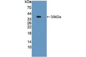 Detection of Recombinant GBP4, Mouse using Polyclonal Antibody to Guanylate Binding Protein 4 (GBP4) (GBP4 antibody  (AA 1-304))