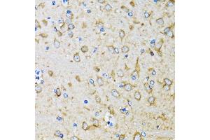 Immunohistochemistry of paraffin-embedded mouse brain using MAP1LC3B antibody. (LC3B antibody)
