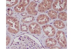 Immunohistochemical analysis of paraffin-embedded human kidney, using NF-κB p105/p50 Antibody. (Recombinant NFkB antibody)