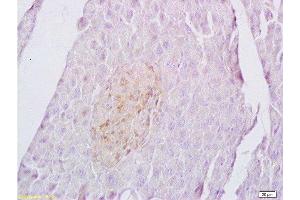 Formalin-fixed and paraffin embedded rat spleen labeled with Anti-Sema4C/SEMA5A Polyclonal Antibody, Unconjugated  at 1:200 followed by conjugation to the secondary antibody and DAB staining. (SEMA4C antibody  (AA 751-833))