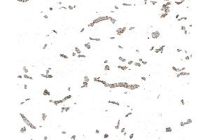 Immunocytochemistry (ICC) image for anti-Desmoglein 3 (DSG3) antibody (ABIN7795599)