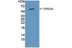 Detection of Recombinant PRKAb1, Human using Polyclonal Antibody to Protein Kinase, AMP Activated Beta 1 (PRKAb1) (PRKAB1 antibody  (AA 13-242))