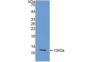 Detection of Recombinant IL8, Rabbit using Monoclonal Antibody to Interleukin 8 (IL8) (IL-8 antibody  (AA 23-101))