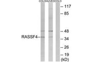 Western blot analysis of extracts from COLO/HuvEc cells, using RASSF4 Antibody.