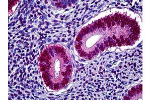 Anti-PGR / Progesterone Receptor antibody IHC of human uterus. (Progesterone Receptor antibody)