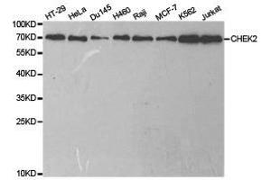 Western Blotting (WB) image for anti-Checkpoint Kinase 2 (CHEK2) antibody (ABIN1871829) (CHEK2 antibody)